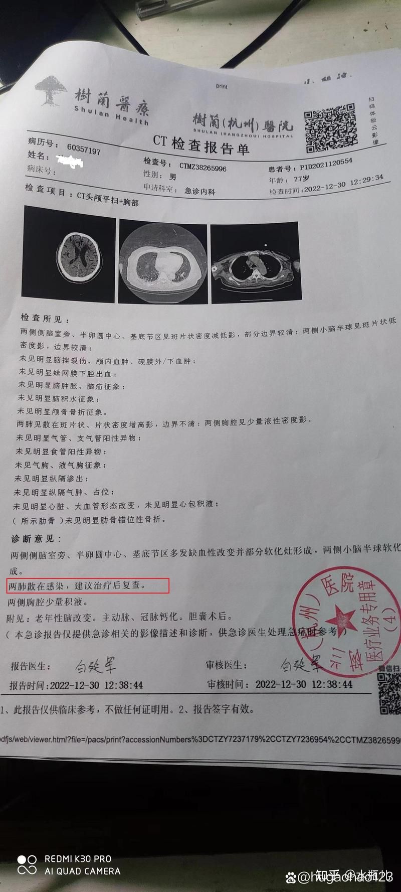 文山壮族苗族自治州新增13例死亡病例，涉及诸暨市/文山市新冠状病毒肺炎情况